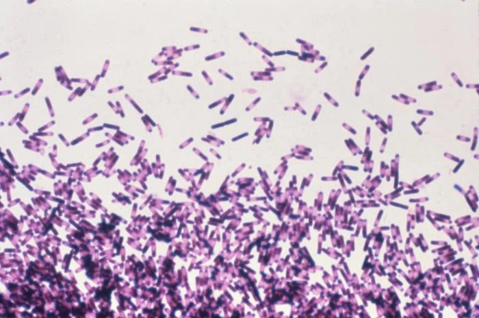 Potential Botulism Sparks Coffee Recall: What Consumers Need to Know   Wisconsi…