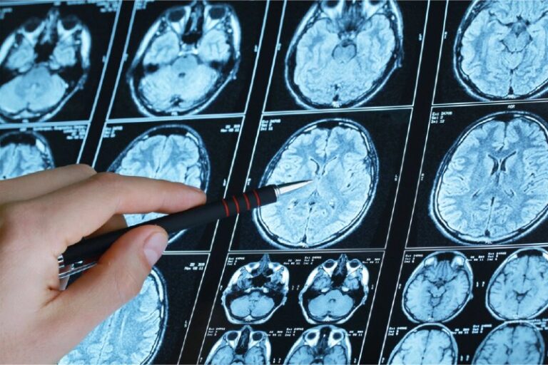 Major Updates on Blood Pressure GuidelinesRead more https://theepochtim.es/s315…