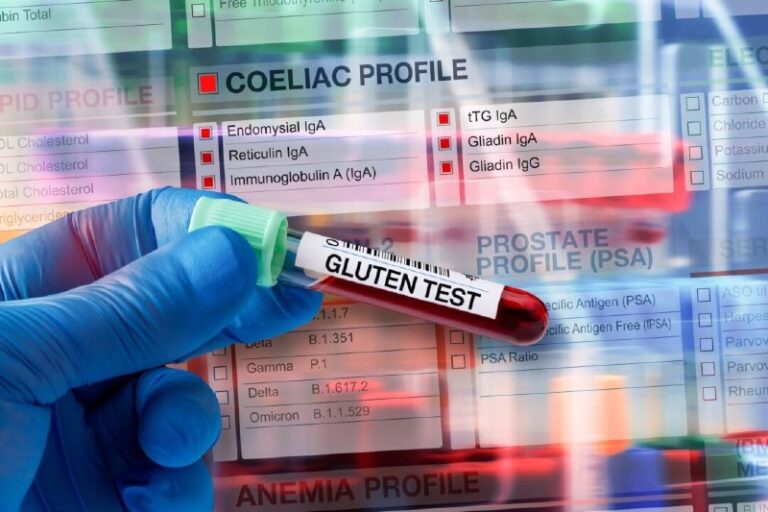 Medical Warning: Gluten Allergies Affect EveryoneFatigue and depression are at e…