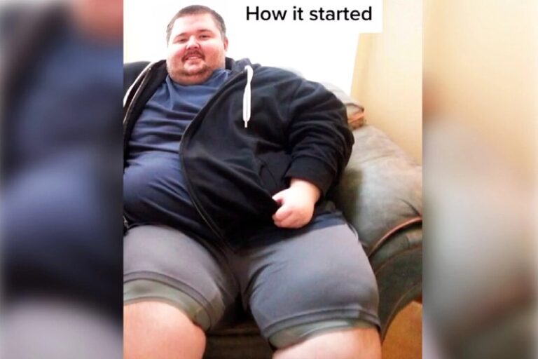 700lb-Wheelchair-Bound Man Sheds 400lbs Over 5 Years Without Surgery—He’s Now U…