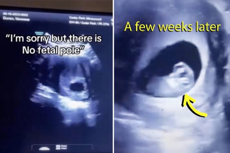 Woman’s Gut Instinct Saves Her Unborn Baby When Doctor Misdiagnoses ‘Just an Em…